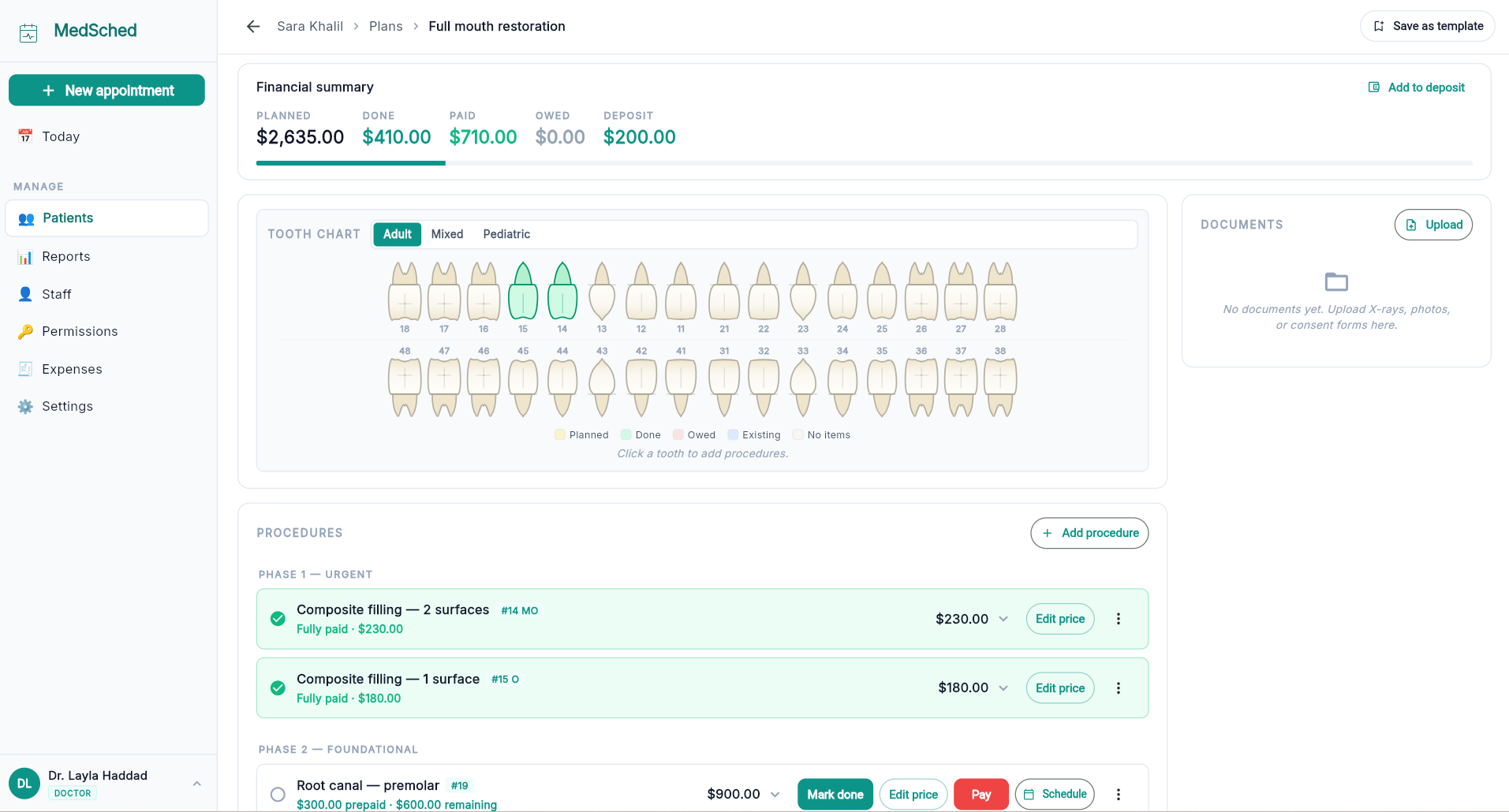 Treatment plan with interactive dental tooth chart and item-by-item pricing